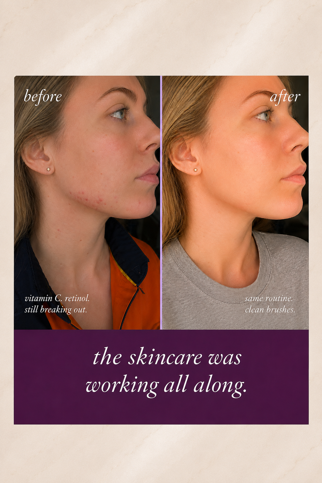 Your Makeup Brushes Are Quietly Undoing Everything Your Skincare Does.